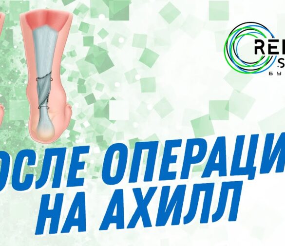 Хольгер Руне перенесет операцию на ахилловом сухожилии и пропустит длительный срок